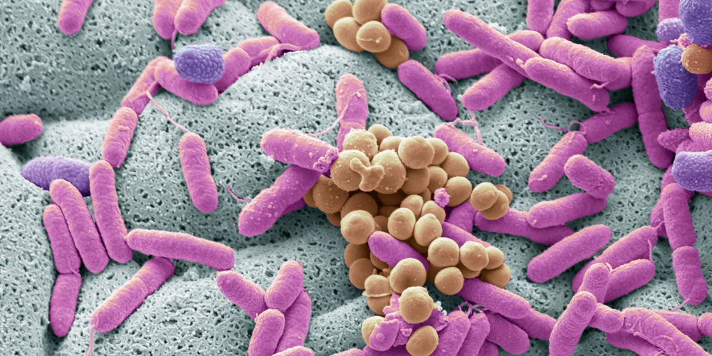 pink microbes